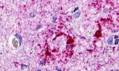 Immunohistochemistry-Paraffin: CCR11 Antibody - BSA Free [NLS1441]