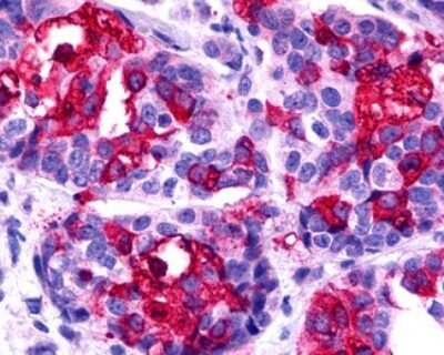 Immunohistochemistry-Paraffin: CCR11 Antibody - BSA Free [NLS1442]