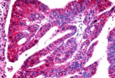 Immunohistochemistry-Paraffin: CCR11 Antibody - BSA Free [NLS1442]