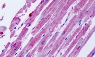 Immunohistochemistry-Paraffin: CCR11 Antibody - BSA Free [NLS1442]