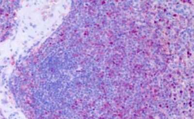 Immunohistochemistry-Paraffin: CCR11 Antibody - BSA Free [NLS1442]