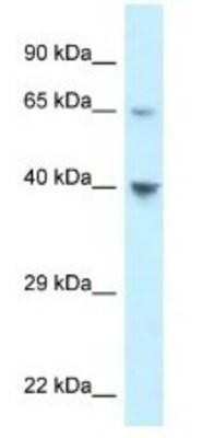 Western Blot: CCR11 Antibody [NBP1-79925]