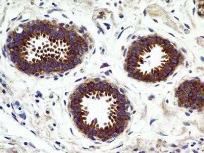 Immunohistochemistry-Paraffin: CCR2 Antibody (2D8) - Azide and BSA Free [NBP2-80622]