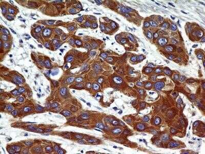 Immunohistochemistry-Paraffin: CCR2 Antibody (2D8) - Azide and BSA Free [NBP2-80622]