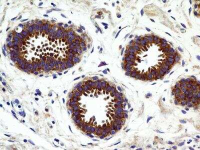 Immunohistochemistry-Paraffin: CCR2 Antibody (2D8) - BSA Free [NBP2-35333]