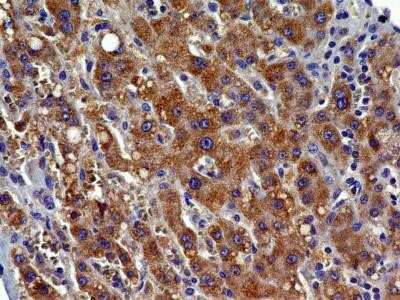 Immunocytochemistry: CCR2 Antibody (3G7) - Azide and BSA Free [NBP2-80623]