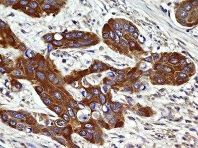 Immunohistochemistry: CCR2 Antibody (3G7) - Azide and BSA Free [NBP2-80623]
