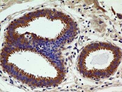 Immunohistochemistry-Paraffin: CCR2 Antibody (3G7) - BSA Free [NBP2-35334]