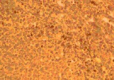 Immunohistochemistry-Paraffin: CCR2 Antibody - BSA Free [NB100-718]