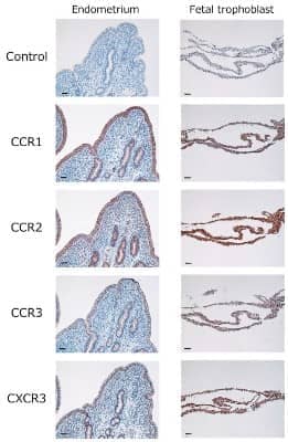 Immunohistochemistry: CCR2 Antibody - BSA Free [NBP1-48337]