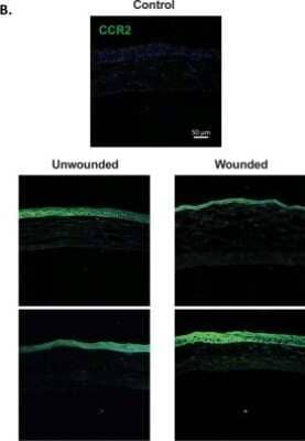 Immunohistochemistry: CCR2 Antibody - BSA Free [NBP1-48338]