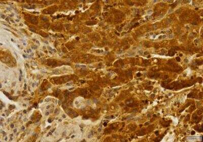 Immunohistochemistry-Paraffin: CCR2 Antibody - BSA Free [NBP1-48337]