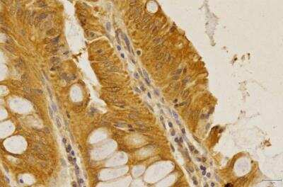 Immunohistochemistry-Paraffin: CCR2 Antibody - BSA Free [NBP1-48337]