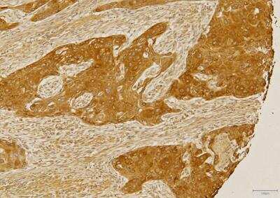 Immunohistochemistry-Paraffin: CCR2 Antibody - BSA Free [NBP1-48337]