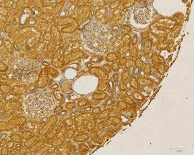 Immunohistochemistry-Paraffin: CCR2 Antibody - BSA Free [NBP1-48337]