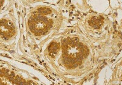 Immunohistochemistry-Paraffin: CCR2 Antibody - BSA Free [NBP1-48337]