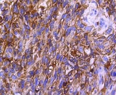 Immunohistochemistry-Paraffin: CCR2 Antibody (SN707) [NBP2-67700]