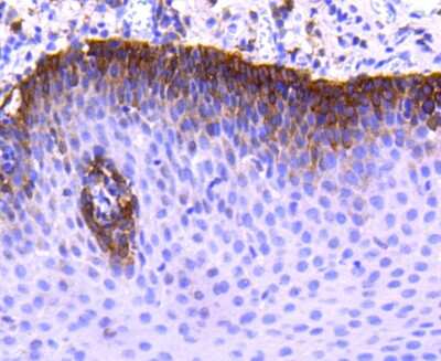 Immunohistochemistry-Paraffin: CCR2 Antibody (SN707) [NBP2-67700]