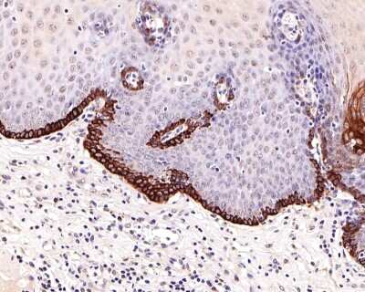 Immunohistochemistry-Paraffin: CCR2 Antibody (SN707) [NBP2-67700]