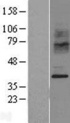 Western Blot: CCR2 Overexpression Lysate [NBL1-08889]