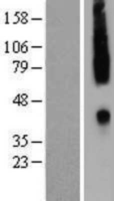 Western Blot: CCR2 Overexpression Lysate [NBP2-09004]