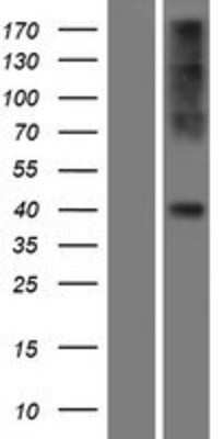 Western Blot: CCR2 Overexpression Lysate [NBP2-09414]