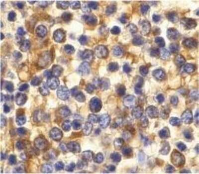 Immunohistochemistry-Paraffin: CCR3 Antibody - BSA Free [NBP1-77065]