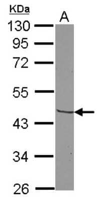 Western Blot: CCR3 Antibody [NBP2-15764]