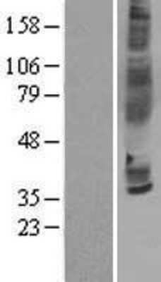 Western Blot: CCR3 Overexpression Lysate [NBL1-08890]