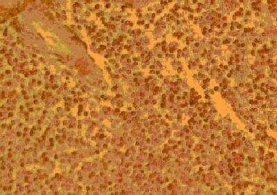 Immunohistochemistry-Paraffin: CCR4 Antibody [NB100-717]