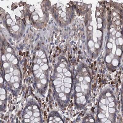 Immunohistochemistry-Paraffin: CCR4 Antibody [NBP1-86584]