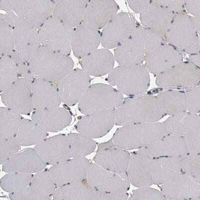 Immunohistochemistry-Paraffin: CCR4 Antibody [NBP1-86584]