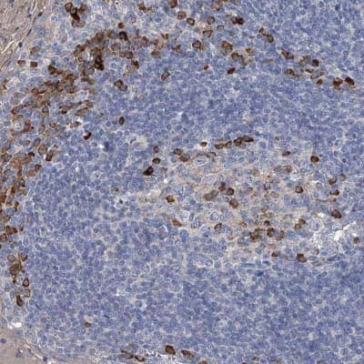 Immunohistochemistry-Paraffin: CCR4 Antibody [NBP1-86584]
