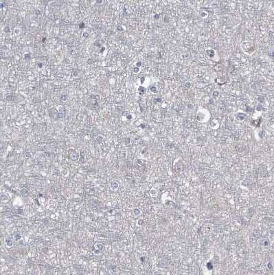 Immunohistochemistry-Paraffin: CCR4 Antibody [NBP1-86584]