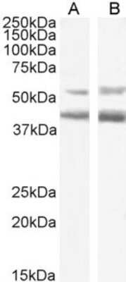 Western Blot: CCR4 Antibody (KW-0761 (Mogamulizumab))ChimericAzide and BSA Free [NBP2-81270]