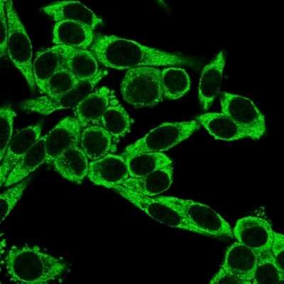 Immunocytochemistry/ Immunofluorescence: CCR5 Antibody (12D1) - Azide and BSA Free [NBP2-47759]