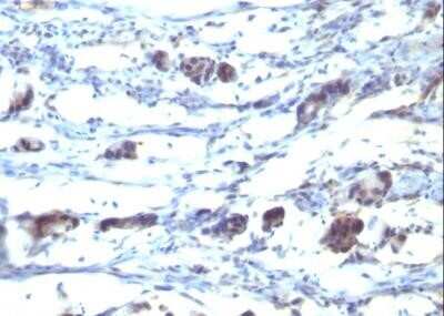 Immunohistochemistry-Paraffin: CCR5 Antibody (12D1) - Azide and BSA Free [NBP2-47759]