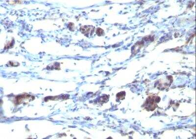 Immunohistochemistry-Paraffin: CCR5 Antibody (12D1) [NBP2-44483]