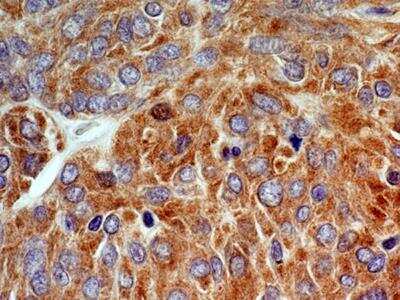 Immunohistochemistry-Paraffin: CCR5 Antibody [NBP2-31374]