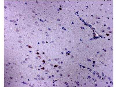 Immunohistochemistry-Paraffin: CCR5 Antibody [NBP2-31374]