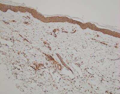 Immunohistochemistry-Paraffin: CCR5 Antibody [NBP2-31374]