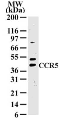 Western Blot: CCR5 Antibody [NB100-56337]