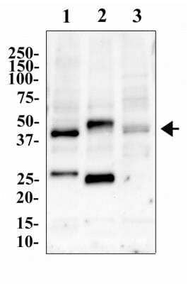 Western Blot: CCR5 Antibody [NBP2-31374]