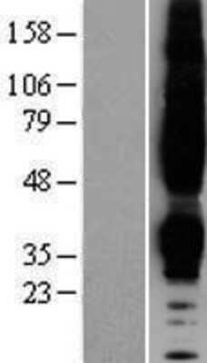 Western Blot: CCR5 Overexpression Lysate [NBP2-09009]