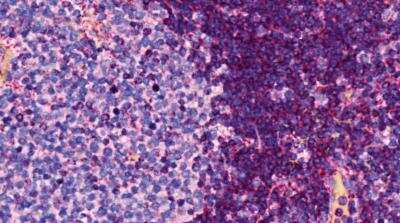 Immunohistochemistry-Paraffin: CCR6 Antibody (MM0066-3L1) - Azide and BSA Free [NBP2-12131]