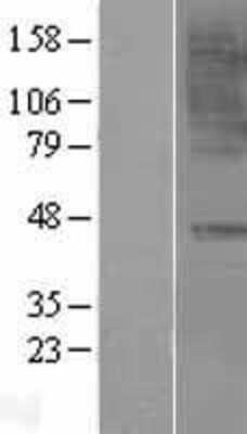 Western Blot: CCR6 Overexpression Lysate [NBL1-08893]