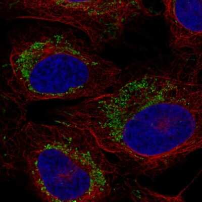 Immunocytochemistry/ Immunofluorescence: CCR7 Antibody [NBP2-58753]