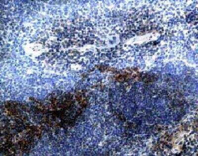 Immunohistochemistry-Paraffin: CCR7 Antibody [NB100-712]