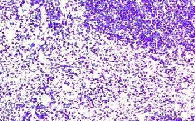 Immunohistochemistry-Paraffin: CCR7 Antibody [NB100-712]