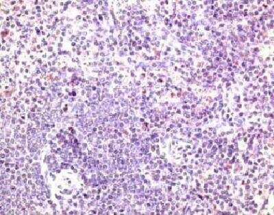 Immunohistochemistry-Paraffin: CCR7 Antibody [NB100-712]